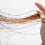 Women’s Hair Loss