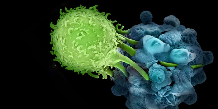 New Cancer Treatments Using Immunotherapy Technologies