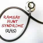 ramsay hunt syndrome symptoms