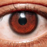 5 Clear Symptoms of Thyroid Eye Disease